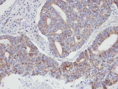 Immunohistochemistry-Paraffin: ARPC3 Antibody [NBP1-31422]