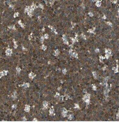 Immunohistochemistry-Paraffin: ARPC3 Antibody [NBP1-89016]