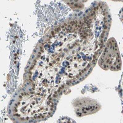 Immunohistochemistry-Paraffin: ARPC3 Antibody [NBP1-89016]