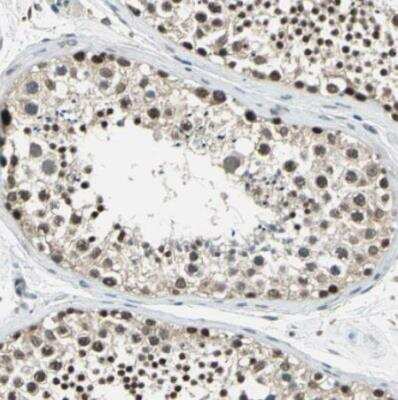 Immunohistochemistry-Paraffin: ARPC3 Antibody [NBP1-89016]