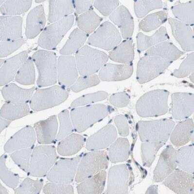 Immunohistochemistry-Paraffin: ARPC3 Antibody [NBP1-89016]