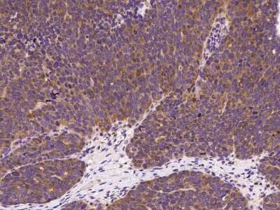 Immunohistochemistry-Paraffin: ARPC3 Antibody [NBP2-99559]