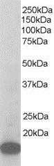 Western Blot: ARPC3 Antibody [NB300-895]