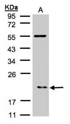 Western Blot: ARPC3 Antibody [NBP1-31422]