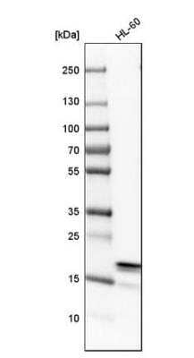 Western Blot: ARPC3 Antibody [NBP1-89016]