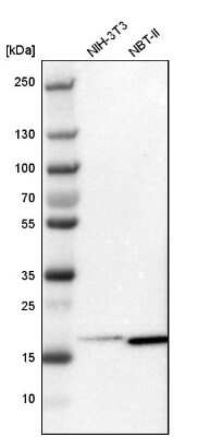 Western Blot: ARPC3 Antibody [NBP1-89016]