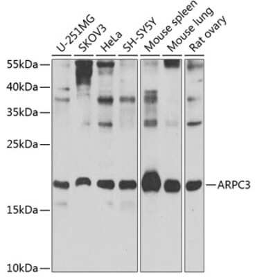 Western Blot: ARPC3 AntibodyBSA Free [NBP2-92679]