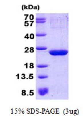 SDS-PAGE: Recombinant Human ARPC3 His Protein [NBP2-22669]