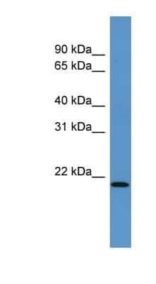 Western Blot: ARPC4 Antibody [NBP1-69003]