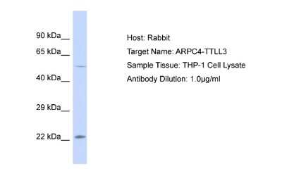 Western Blot: ARPC4 Antibody [NBP2-88769]