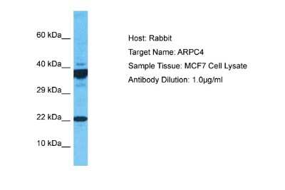 Western Blot: ARPC4 Antibody [NBP2-88770]