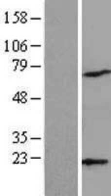 Western Blot: ARPC4 Overexpression Lysate [NBL1-07729]