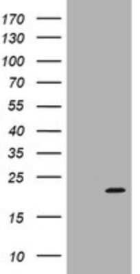 Western Blot: ARPC5 Antibody (OTI2G1) [NBP2-45504]