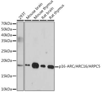 Western Blot: ARPC5 Antibody (7W9M7) [NBP3-16483]