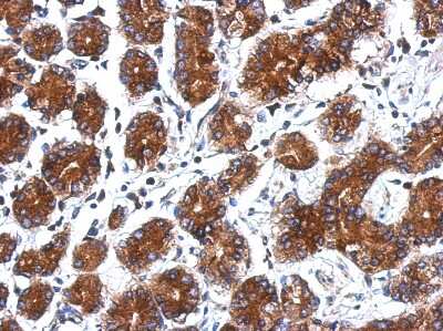Immunohistochemistry-Paraffin: ARPC5 Antibody [NBP2-14878]