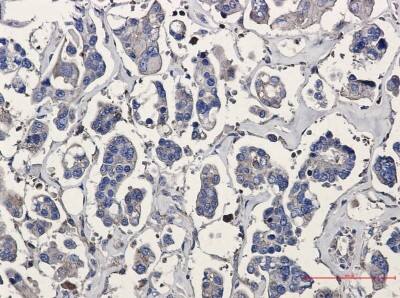 Immunohistochemistry-Paraffin: ARPC5 Antibody (S08-2B3) [NBP3-19937]