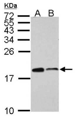 Western Blot: ARPC5 Antibody [NBP2-14878]