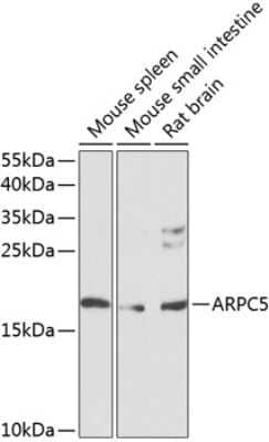 Western Blot: ARPC5 AntibodyBSA Free [NBP2-92560]