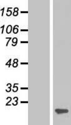 Western Blot: ARPC5 Overexpression Lysate [NBP2-07715]