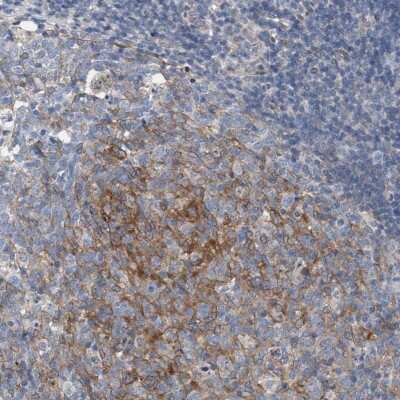 Immunohistochemistry-Paraffin: ARPC5L Antibody [NBP1-89017]