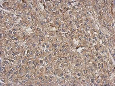 Immunohistochemistry-Paraffin: ARPC5L Antibody [NBP2-15472]
