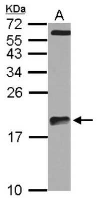 Western Blot: ARPC5L Antibody [NBP2-15472]