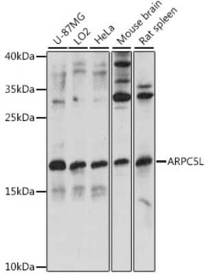 Western Blot: ARPC5L AntibodyAzide and BSA Free [NBP2-92277]