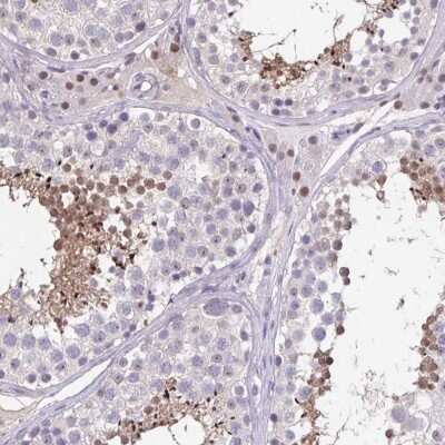 Immunohistochemistry: ARPM1 Antibody [NBP2-34022]