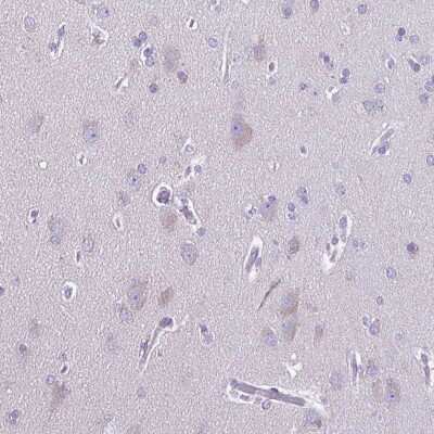 Immunohistochemistry-Paraffin: ARPM1 Antibody [NBP1-90910]