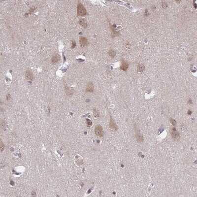 Immunohistochemistry-Paraffin: ARPP-21 Antibody [NBP1-90096]