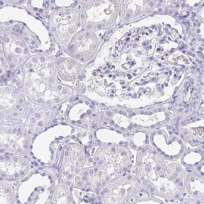 Immunohistochemistry-Paraffin: ARPP-21 Antibody [NBP1-90096]