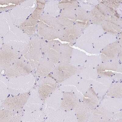 Immunohistochemistry-Paraffin: ARPP-21 Antibody [NBP1-90096]