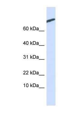 Western Blot: ARPP-21 Antibody [NBP1-54394]