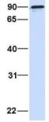 Western Blot: ARPP-21 Antibody [NBP1-54394]