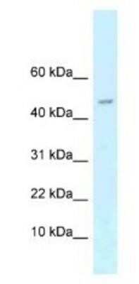 Western Blot: ARPP-21 Antibody [NBP1-82414]