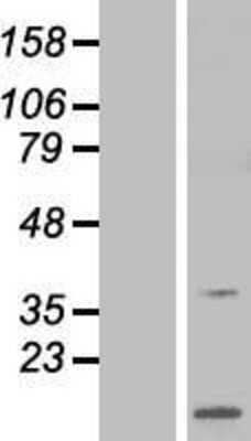 Western Blot: ARPP-21 Overexpression Lysate [NBP2-04732]