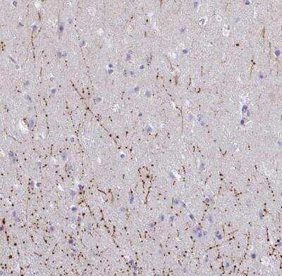 Immunohistochemistry-Paraffin: ARPP19 Antibody [NBP2-31652]