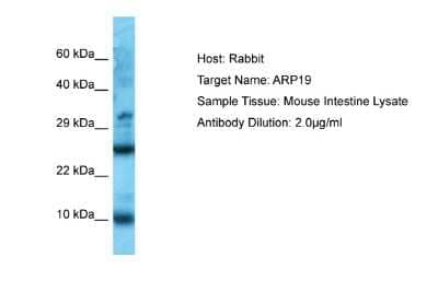 Western Blot: ARPP19 Antibody [NBP2-82671]