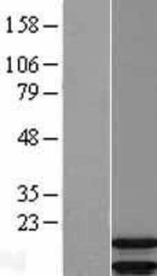 Western Blot: ARPP19 Overexpression Lysate [NBL1-07731]