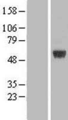 Western Blot: ARRDC1 Overexpression Lysate [NBL1-07734]