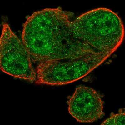 Immunocytochemistry/ Immunofluorescence: ARRDC2 Antibody [NBP2-47547]