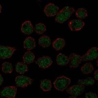 Immunocytochemistry/ Immunofluorescence: ARRDC2 Antibody [NBP3-17468]