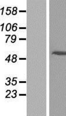 Western Blot: ARRDC2 Overexpression Lysate [NBP2-07128]