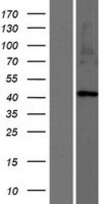 Western Blot: ARRDC2 Overexpression Lysate [NBP2-08637]