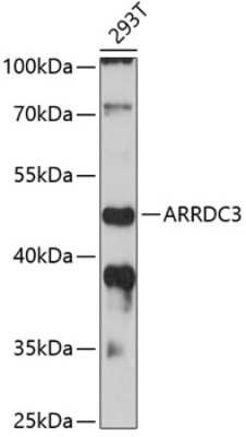 Western Blot: ARRDC3 AntibodyAzide and BSA Free [NBP3-04610]