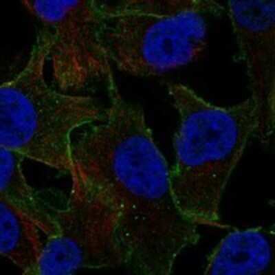 Immunocytochemistry/ Immunofluorescence: ARRDC4 Antibody [NBP3-17343]