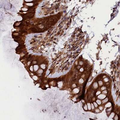 Immunohistochemistry-Paraffin: ARRDC4 Antibody [NBP1-81958]