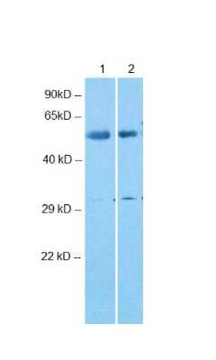 Western Blot: ARRDC4 Antibody [NBP2-82678]