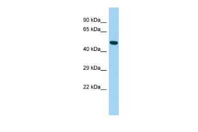 Western Blot: ARRDC4 Antibody [NBP2-82679]