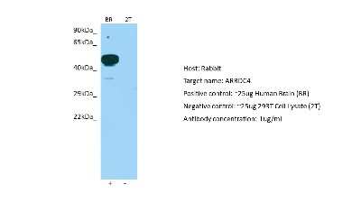 Western Blot: ARRDC4 Antibody [NBP2-82679]